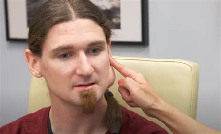 
What Happened To Kevin Olaeta? Dr Pimple Popper Patient Passed Away 